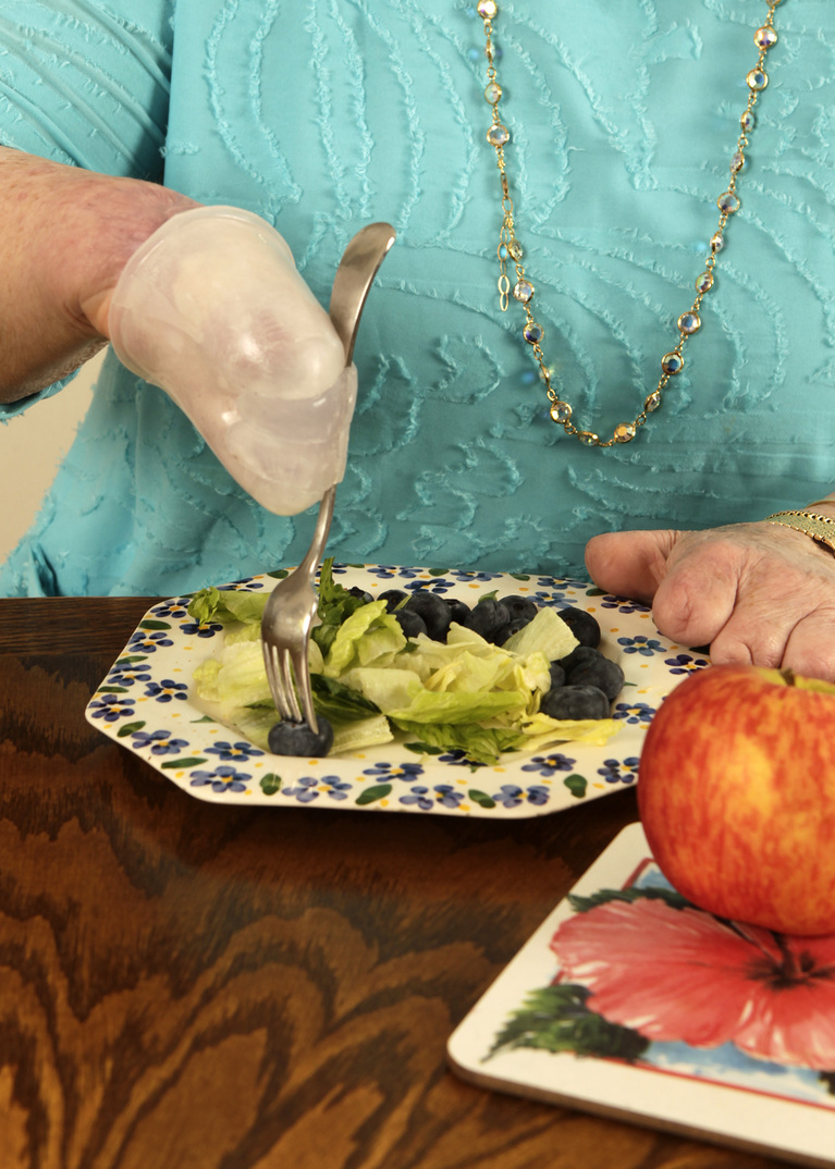 Cindy uses her fork cap for easy eating.
