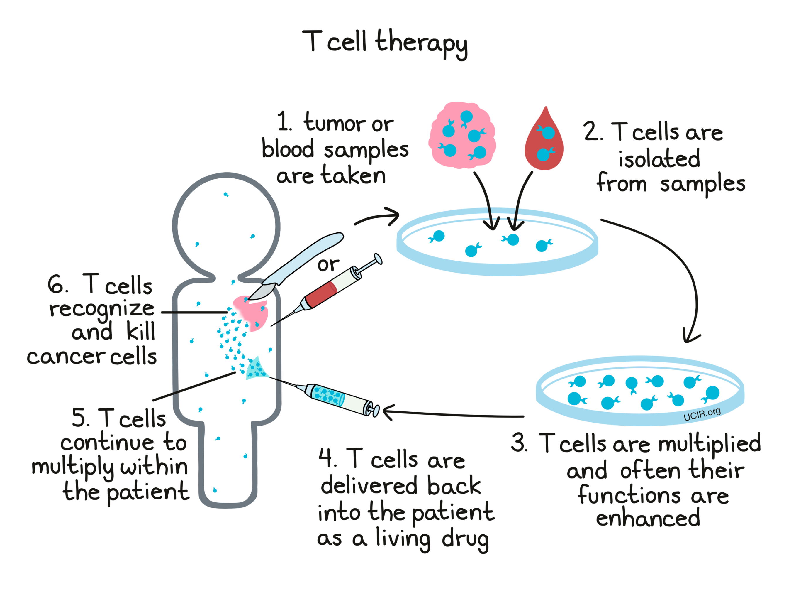 Overview of T cell therapy