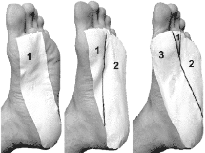 "Plantar