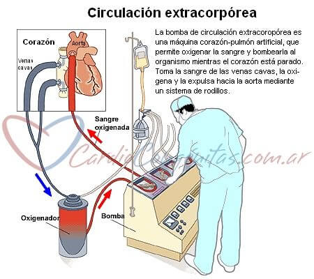 CEC