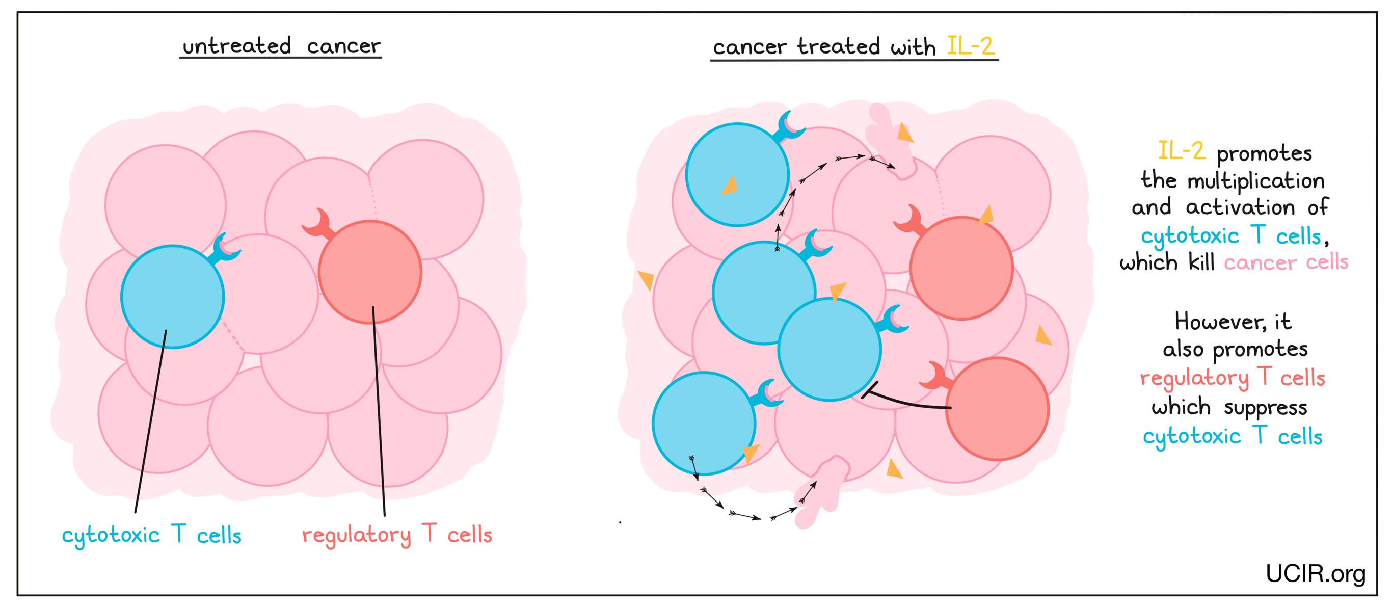 Illustration showing the difference between an untreated cancer vs a cancer treated with IL-2
