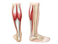 "Plantar