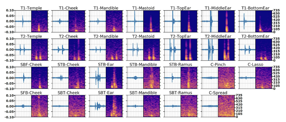 examples of spectrograms for each gesture trained, showing the distinct signatures between gestures recorded.