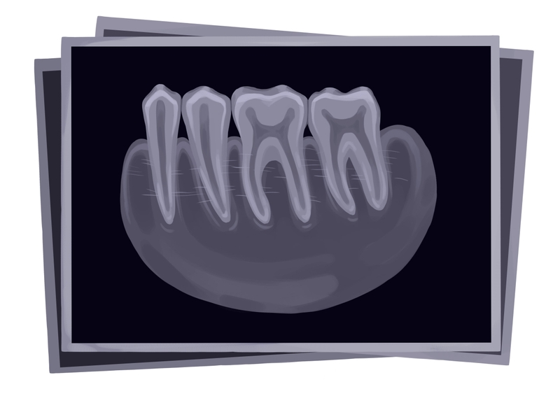 Periapical PA dental x-rays