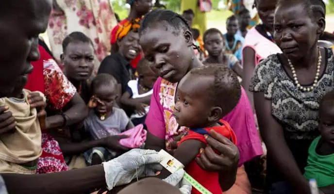 Nutrition clinic in South Sudan
