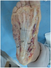 "Plantar