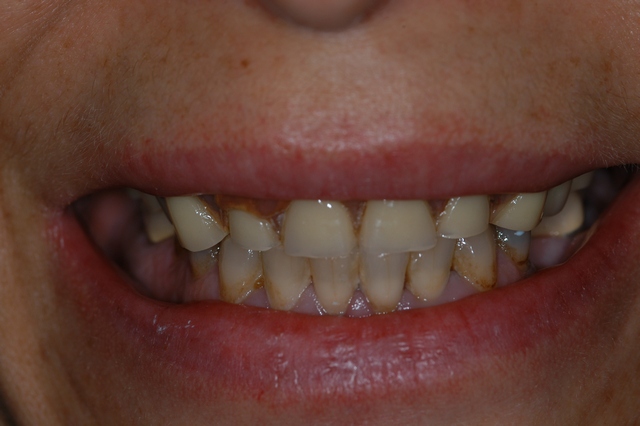 Before