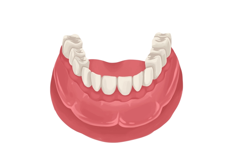Full dentures for lower arch