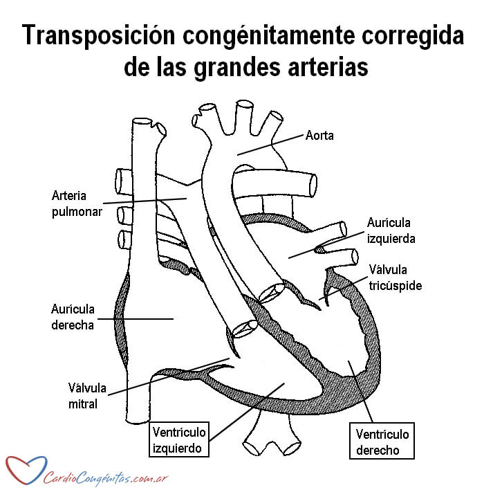 L-TGA-esquema