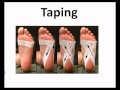"Plantar