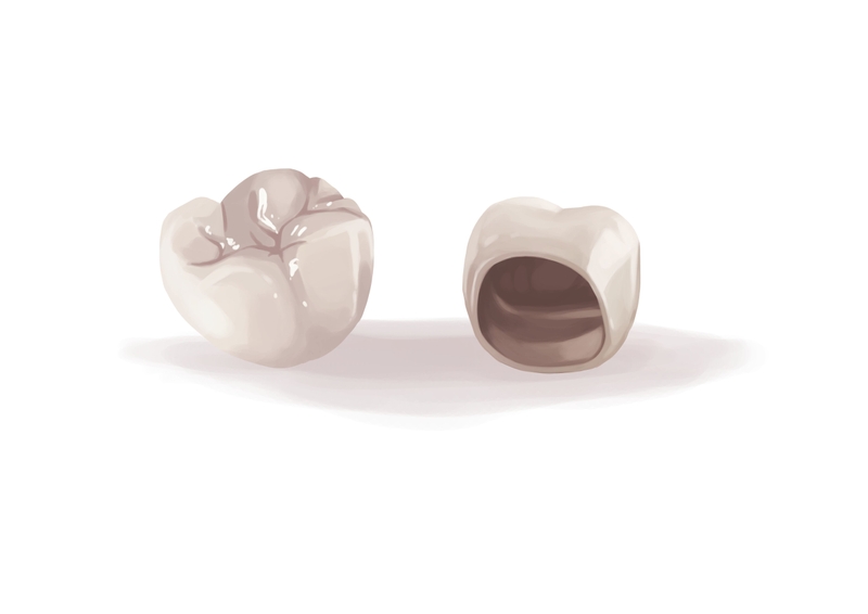 Zirconia crown