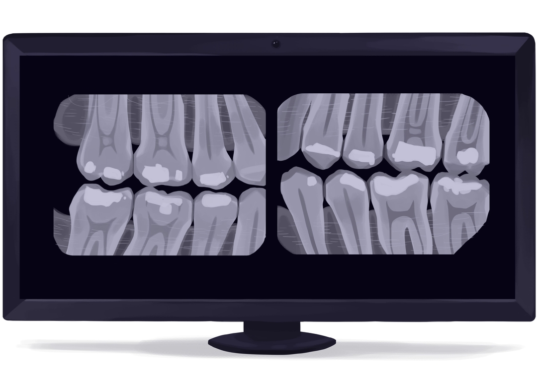 Dental Xray cost, safety, and frequency Authority Dental