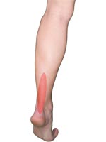 "Plantar