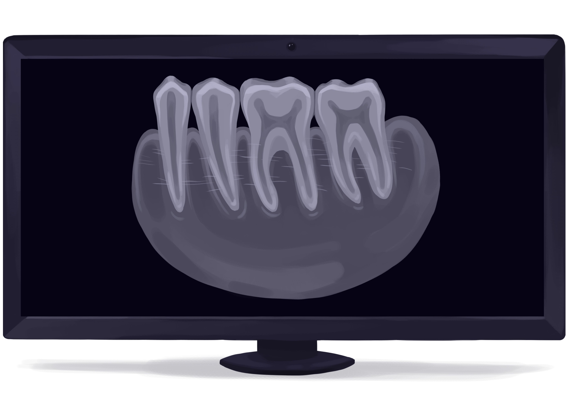 Dental Crowns Cost From 200 Up To 2 500   Ffb608989ebc859379dcfb435a454399 