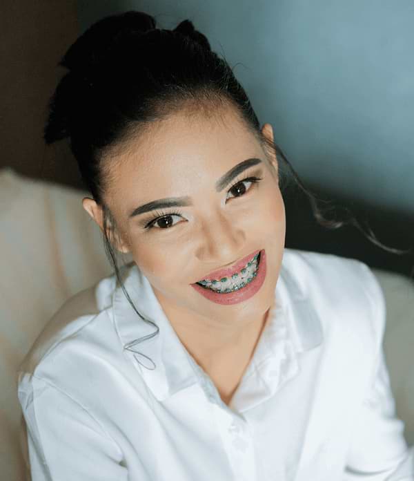 Dental Braces