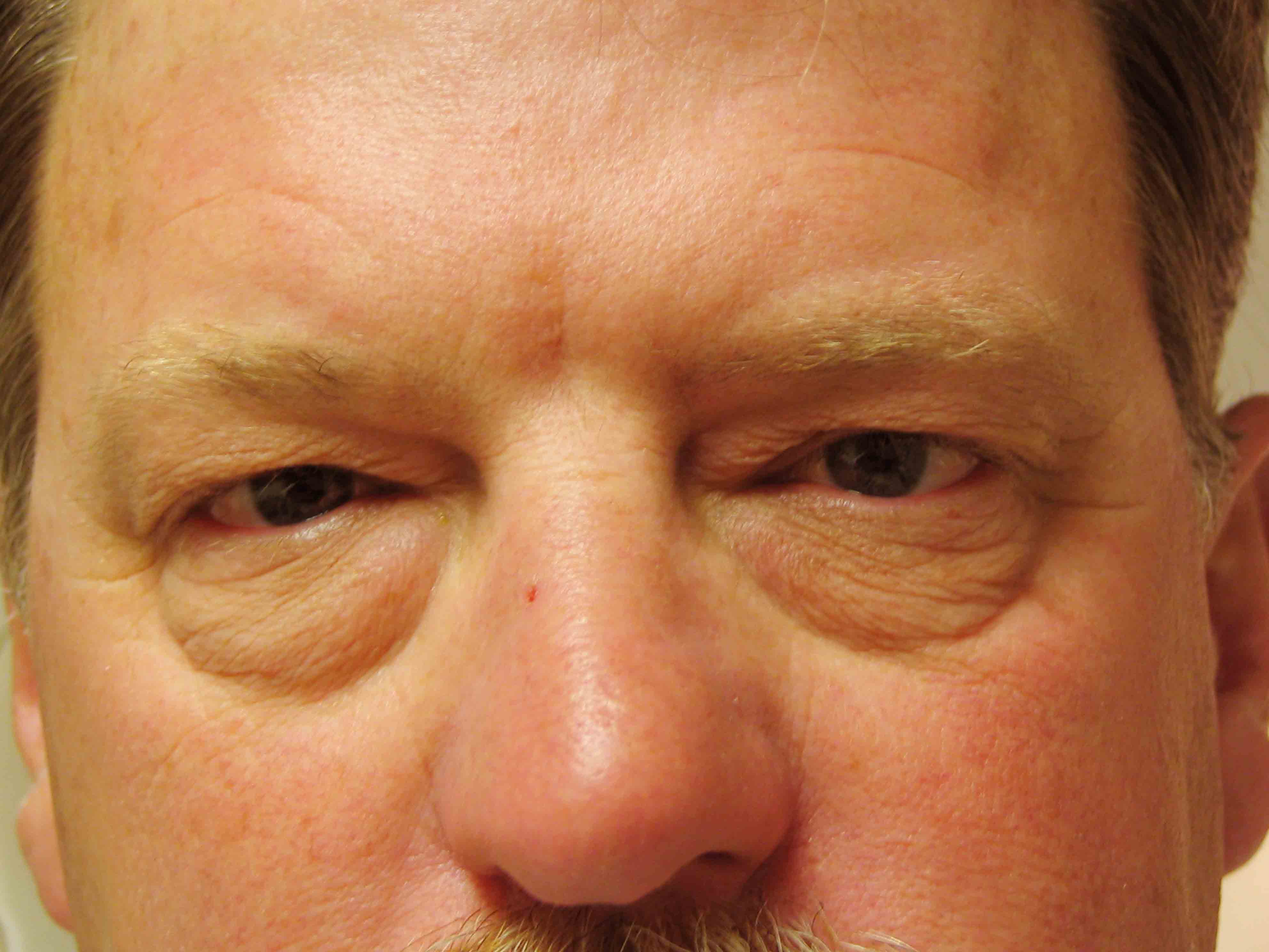 2736-before.JPG