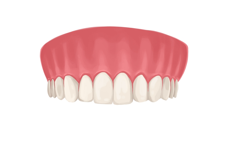 Upper arch of teeth