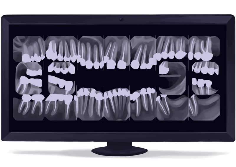 Full-mouth dental X-ray