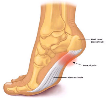 "Plantar