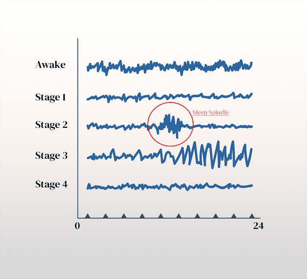 eeg cycle 0 75x