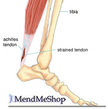 "Plantar