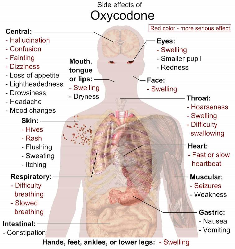 Side effects of Oxycodone