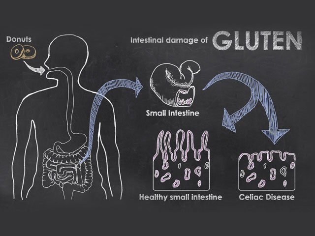 An infographic showing the ingestion of gluten into a body and its affect on the small intestine, all on a chalkboard