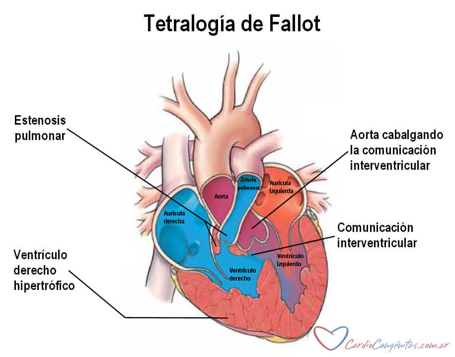 Anatomia-Fallot