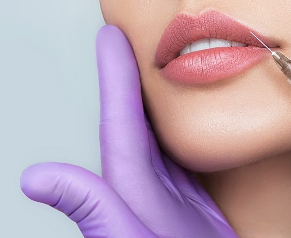 All You Need to Know About Lip Fillers