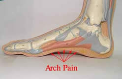"Plantar