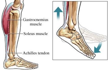 "Plantar