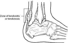 "Plantar