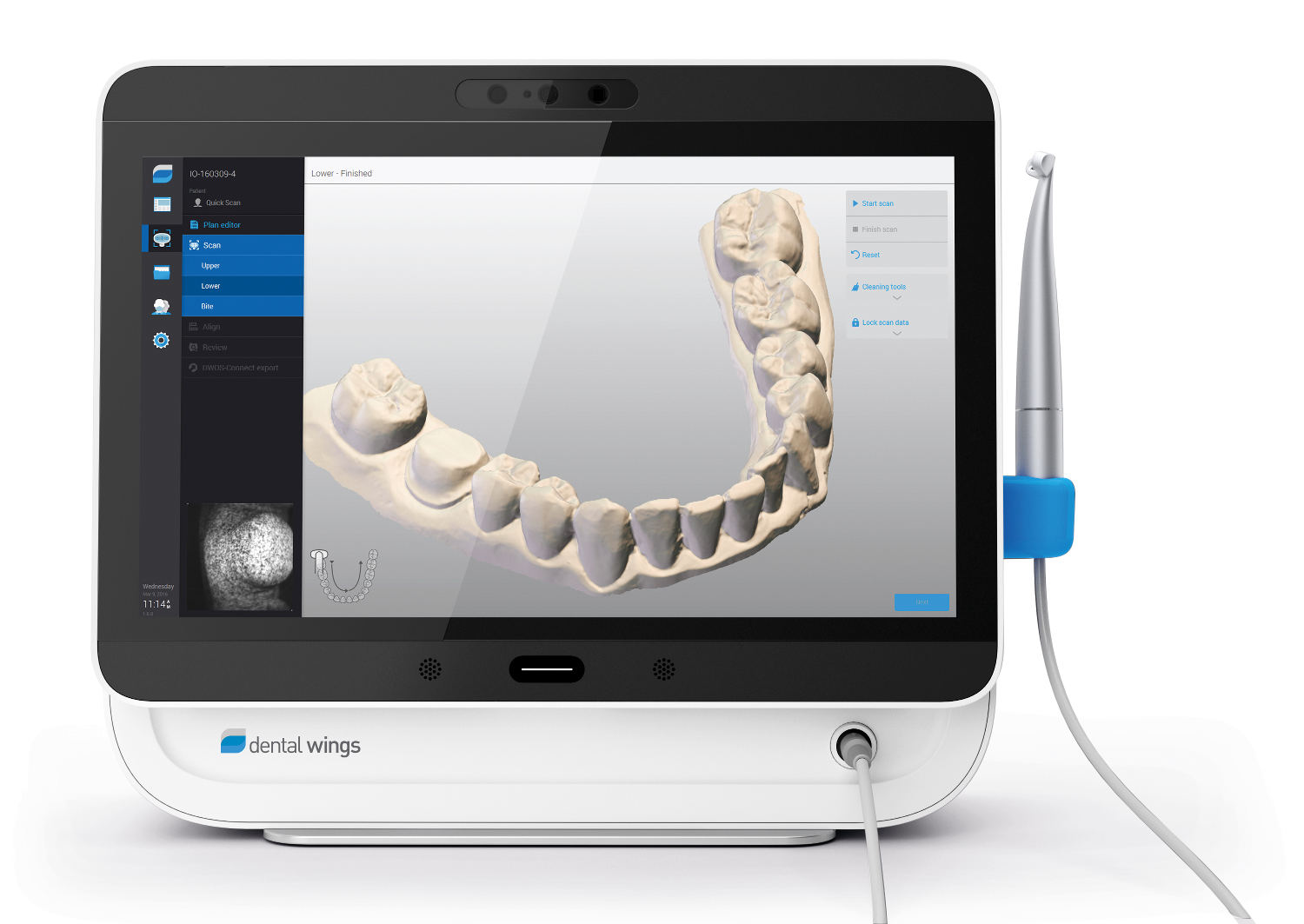 Studio Dentistico Riccardi Lodi - Scanner Intraorale