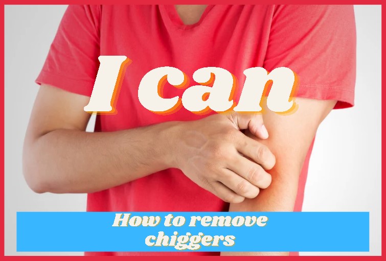 removing chiggers