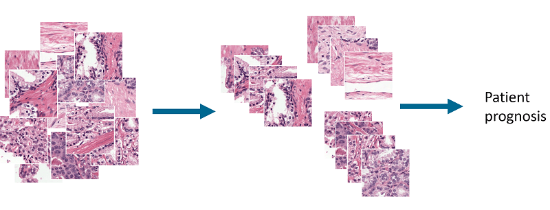 Overview of the idea. By clustering patches of prostate tissue we can make groups that can be used to classify tissue and used for patient prognosis.