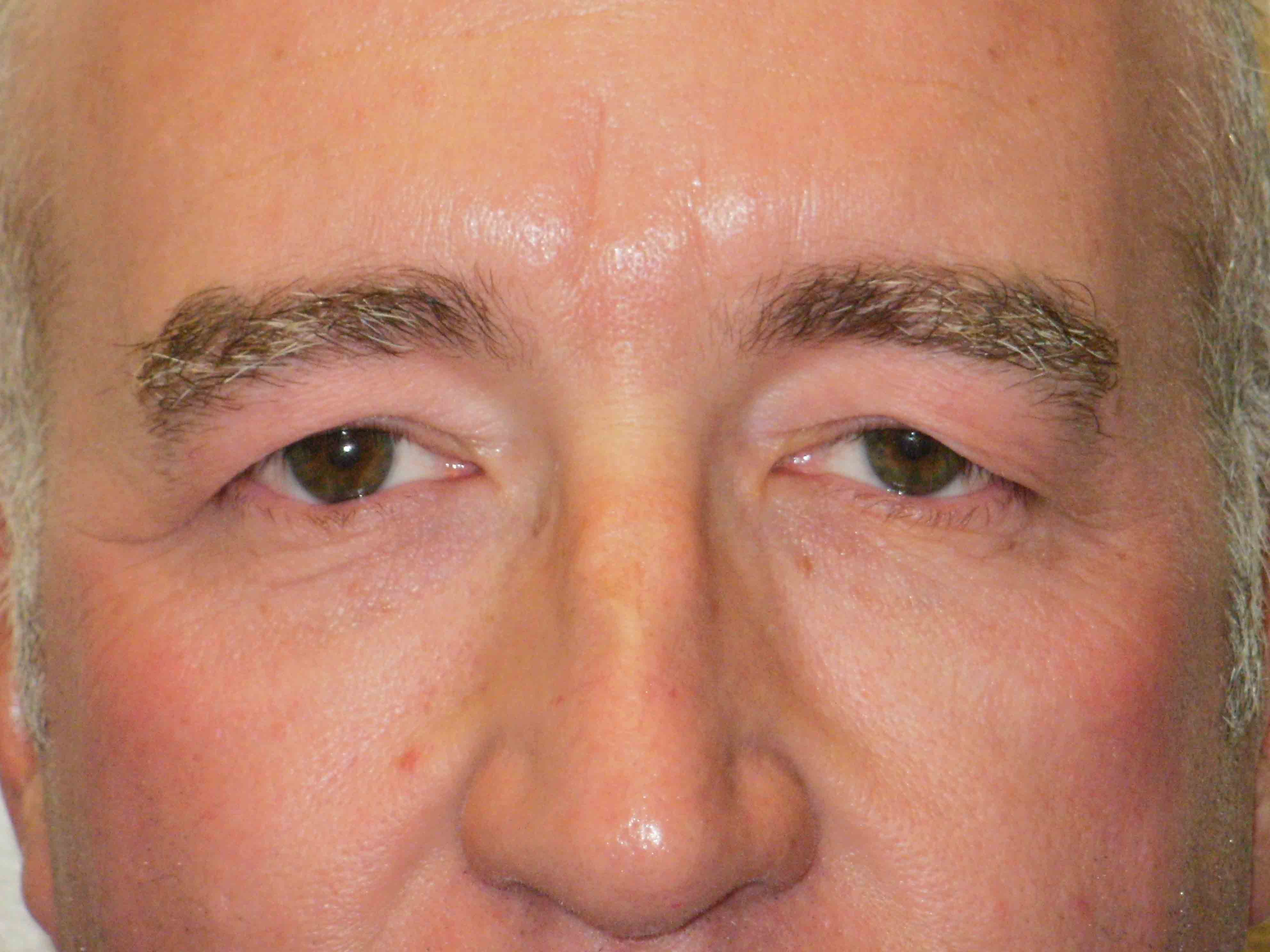 9325-before.JPG