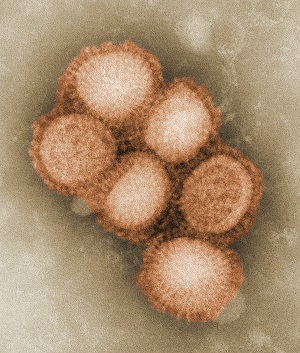 Digitally-colorized, negative-stained transmission electron microscopic (TEM) image depicted some of the ultrastructural morphology of the A/CA/4/09 Swine Flu virus.