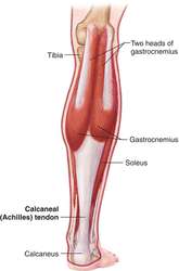 "Plantar