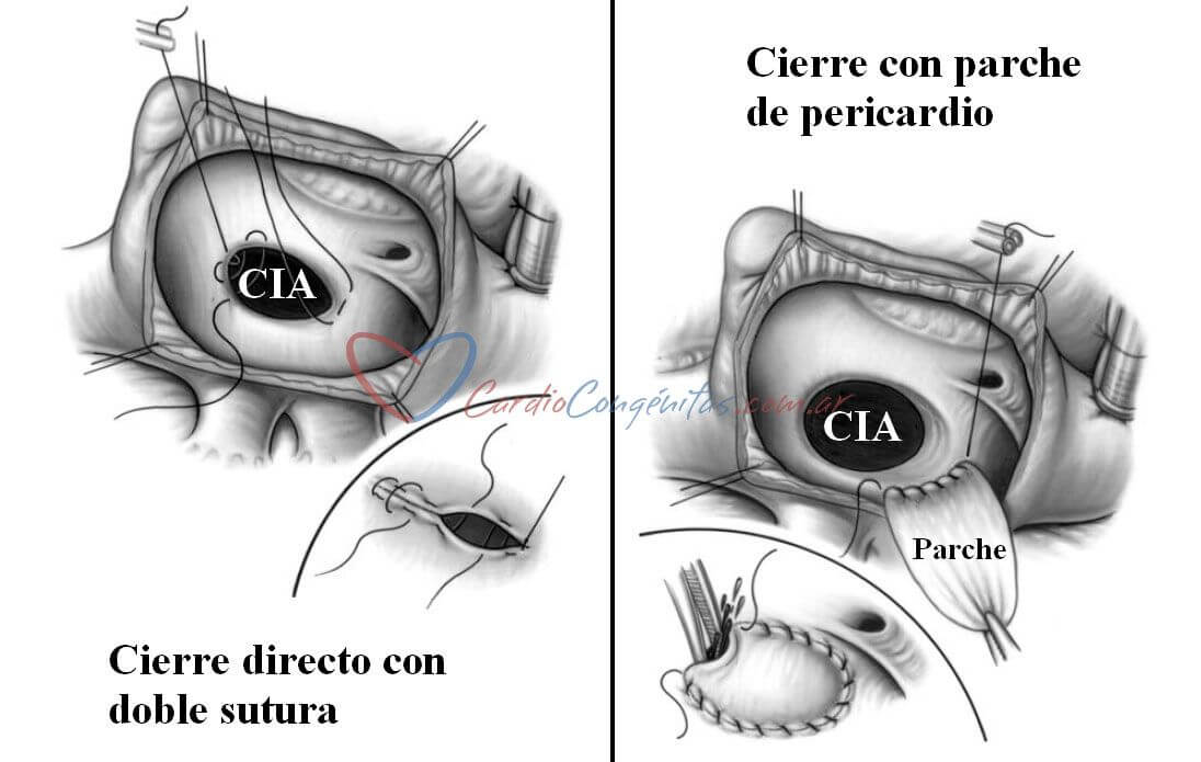 Cierre-de-CIA