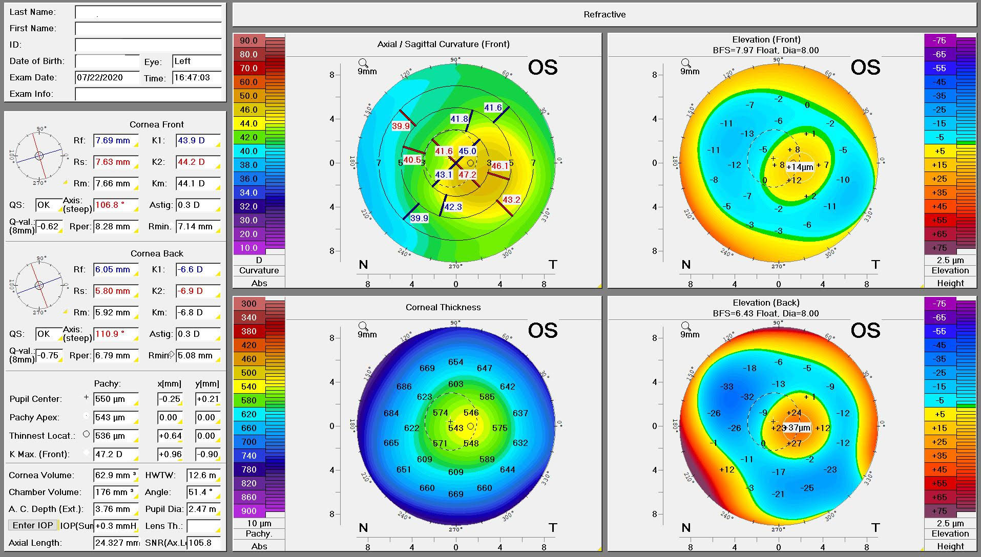 Corneal Tomography Innovative Eye Care