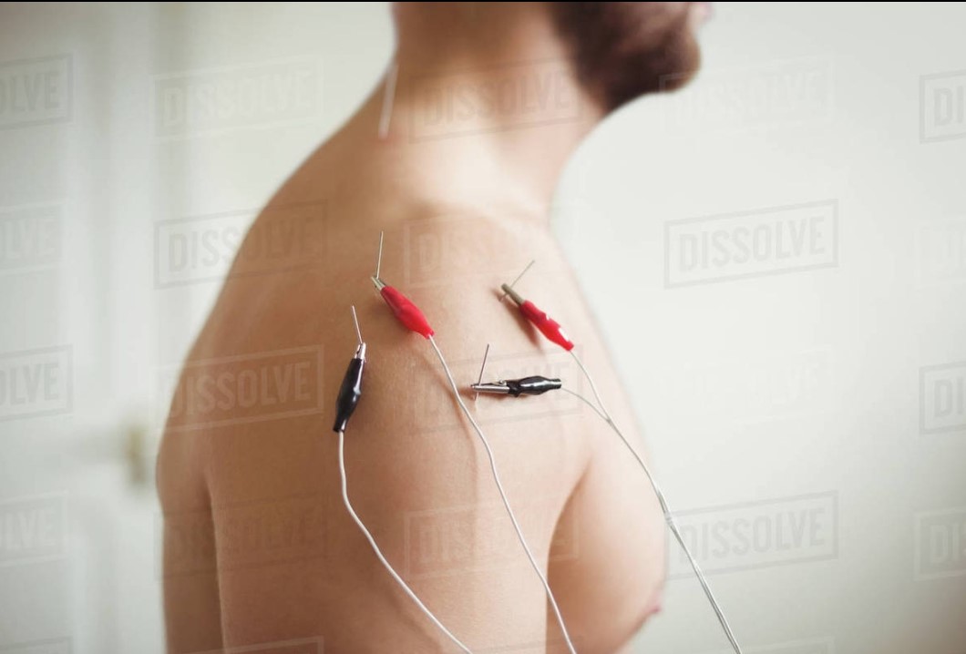 electroTherapy
