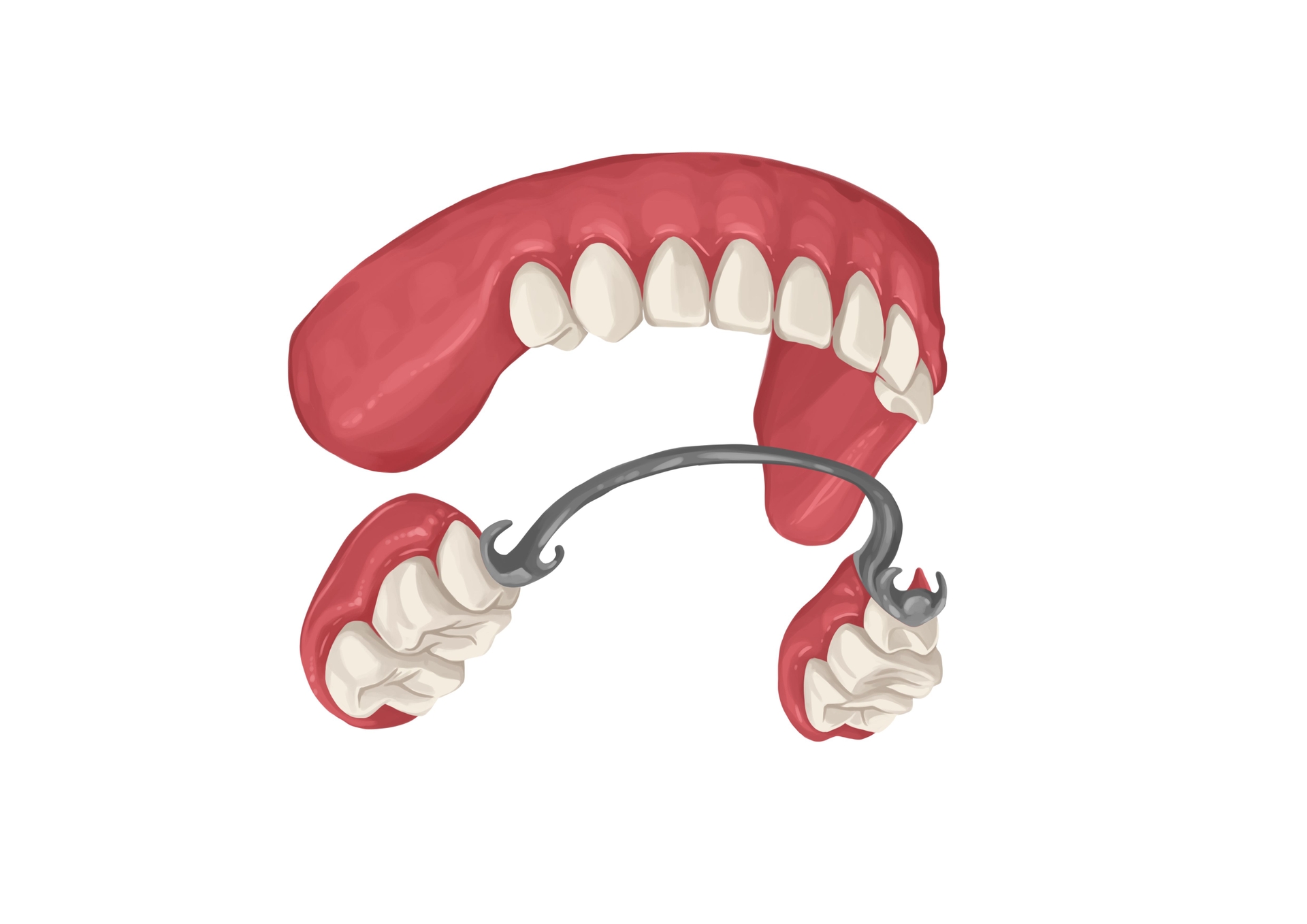 Dentures cost from 300 up to 3,500