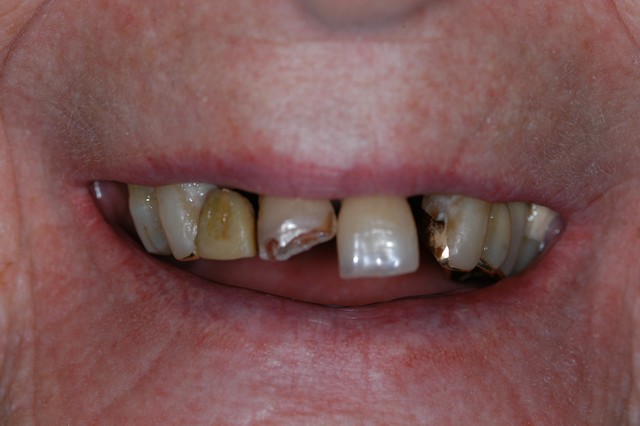 Before