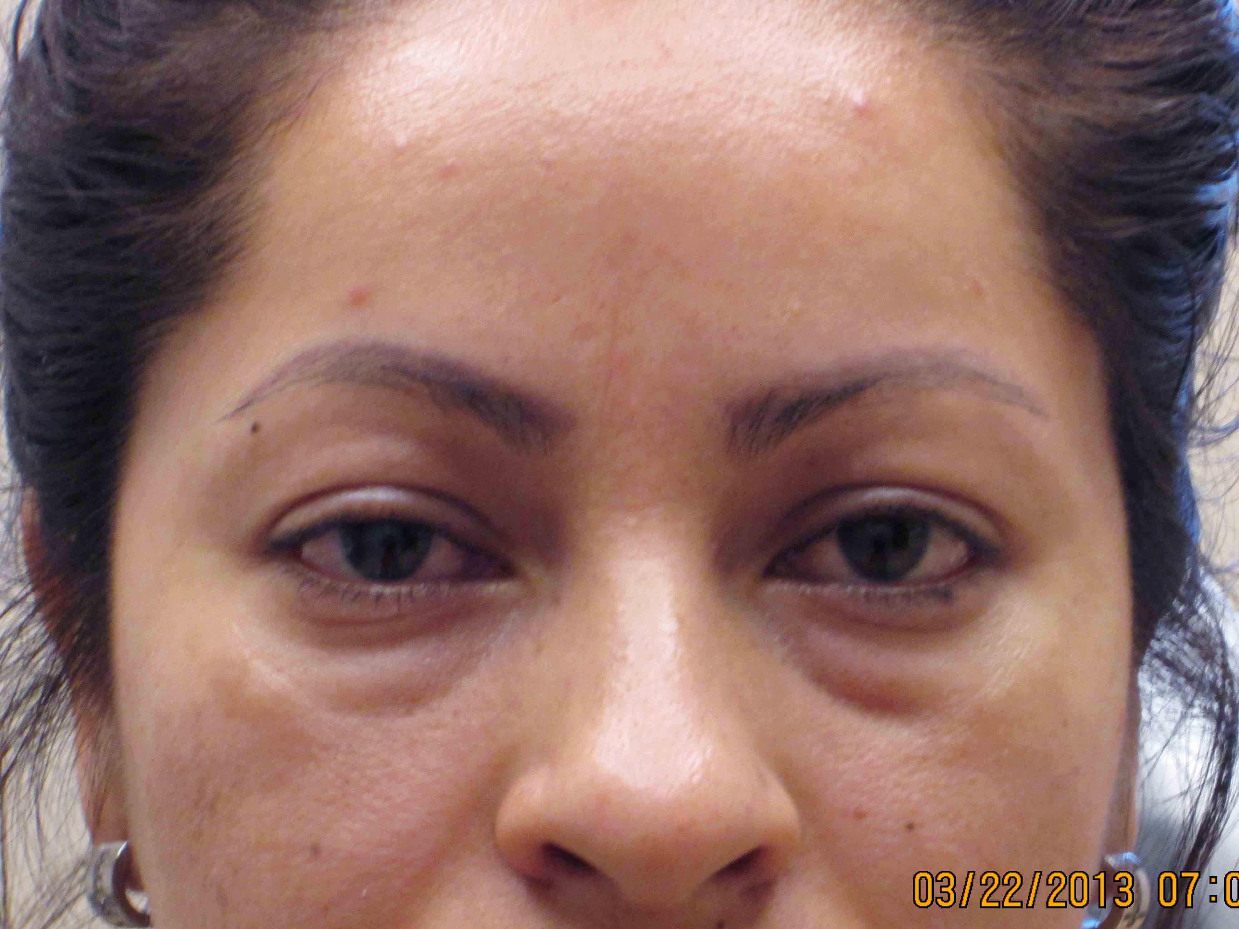 13284-before.jpg