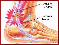 "Plantar