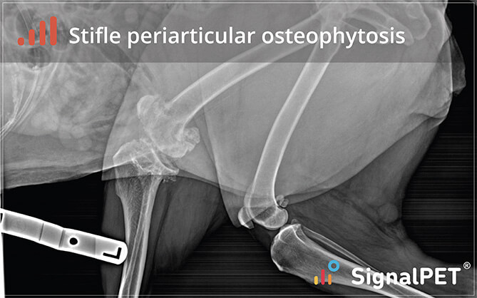 elbow_periarticular_osteophytosis2