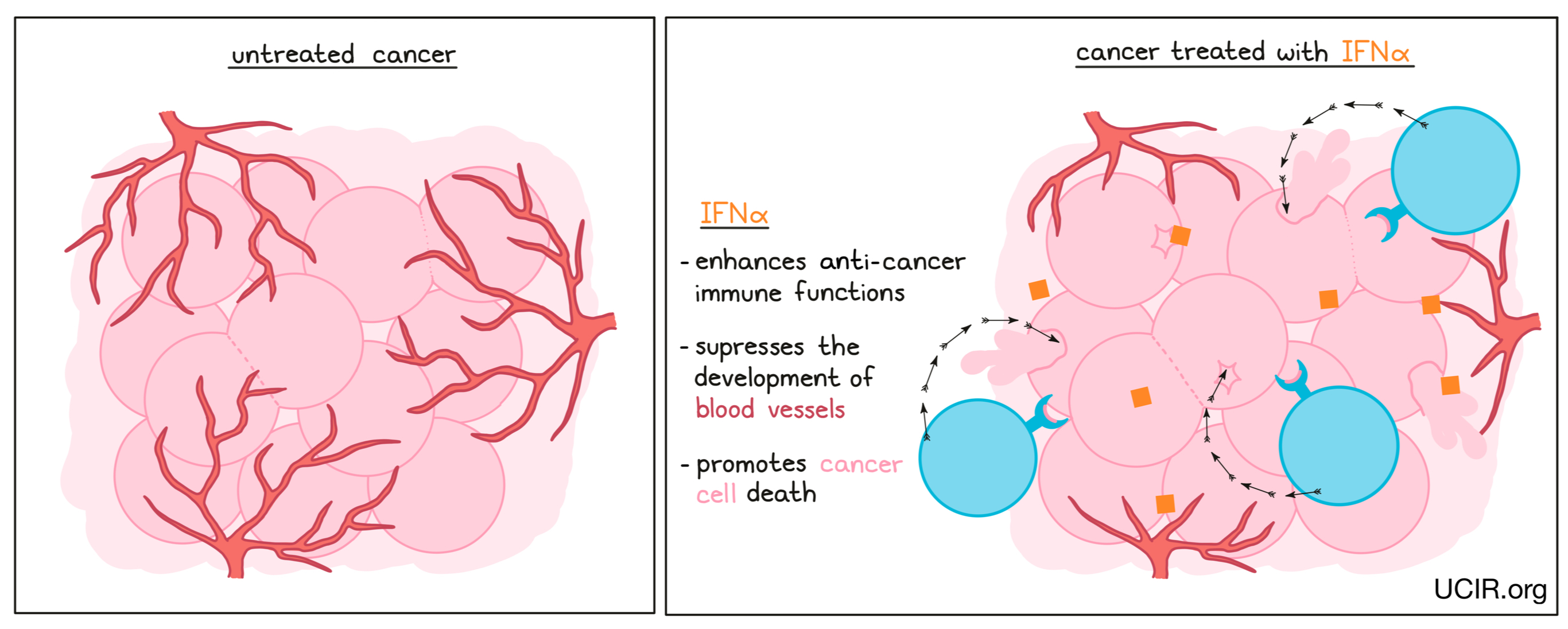 Illustration showing the difference between an untreated cancer vs a cancer treated with IFNα