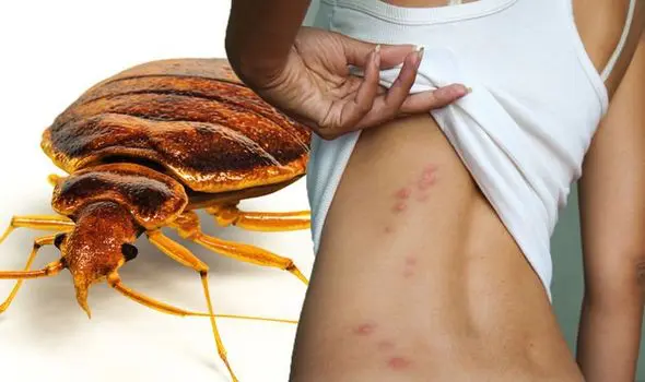 Bed bugs bites on the back of a person