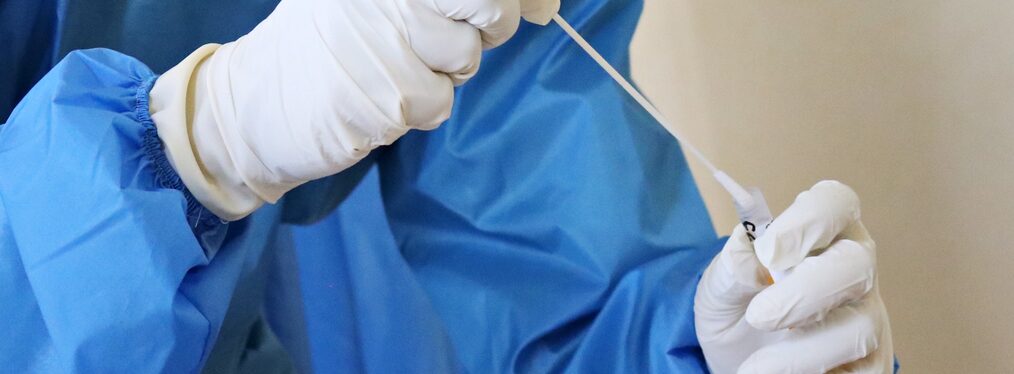 Hände halten ein Stäbchen und einen Coronavirus-Test.