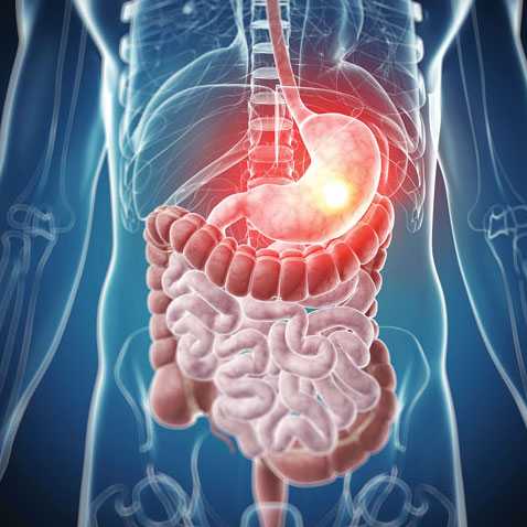 Appropriate Therapeutic Drug Monitoring of Biologic Agents for Patients With Inflammatory Bowel Diseases